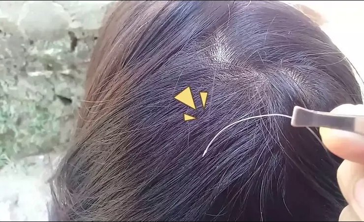 4 Cara Mengatasi Uban Agar Tidak Tumbuh Lagi di Usia Muda-sumber foto orami